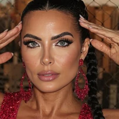 Carla Prata fala sobre diagnóstico de doença rara autoimune