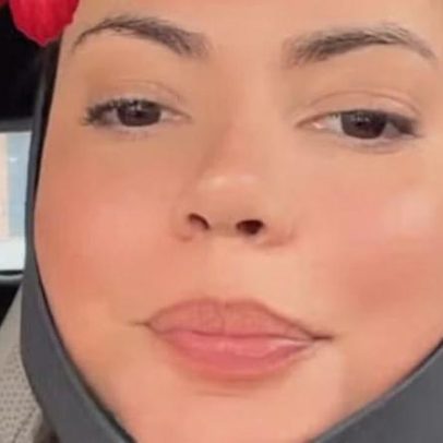 Fernanda Bande revela novo procedimento estético