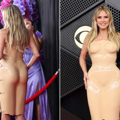 Heidi Klum mostra machucados por vestido de látex nude no Grammy 2026