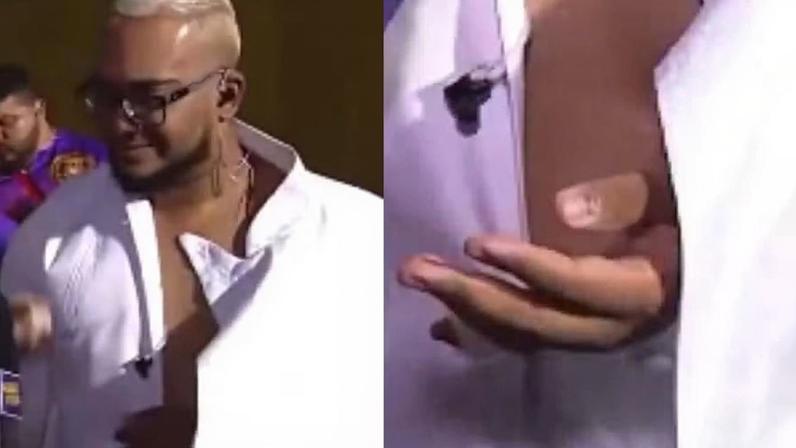 Intérprete da Em Cima Da Hora desfila na Sapucaí com fratura exposta