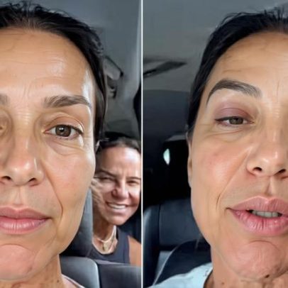 Síndrome vasovagal causa desmaio e hospitalização de Ivete Sangalo