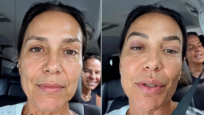 Ivete Sangalo recebe alta de hospital após desmaiar e receber pontos no rosto — Foto: Reprodução/Instagram