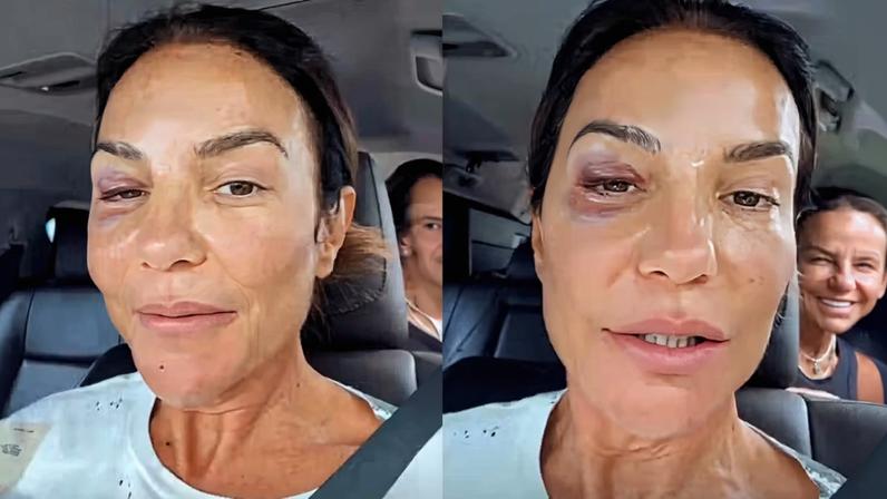 Ivete Sangalo tranquiliza fãs após ser hospitalizada às pressas — Foto: Reprodução/Instagram
