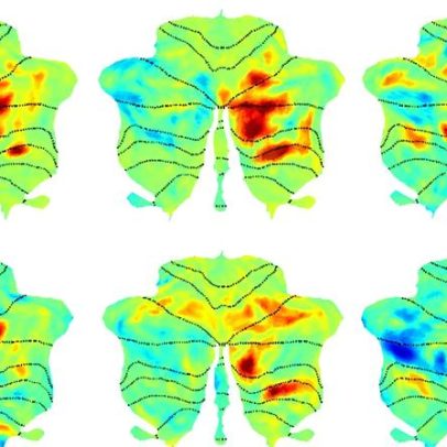 Rede linguística satélite no cérebro identificada em estudo