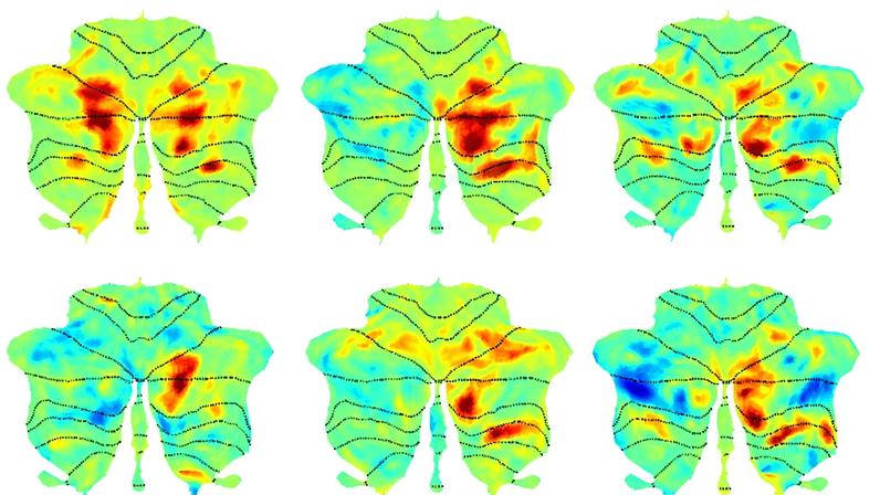 Brain scans illustrate cerebellar responses (red) to language in six study participants.