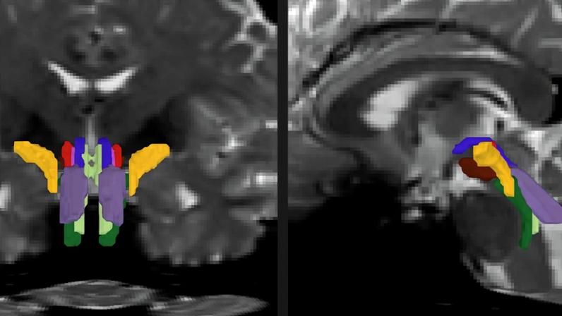 In two panels there are face-on and side-view cross sections of a human brain in pixellated gray. In the bottom center of each image color-coded crescent shapes delineate discrete nerve fiber bundles.