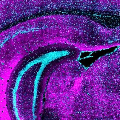 Como uma classe única de neurônios pode moldar o desenvolvimento cerebral