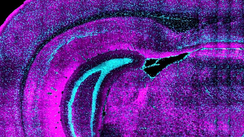 Cross section of mouse tissue that appears perfused with magenta and cyan staining.