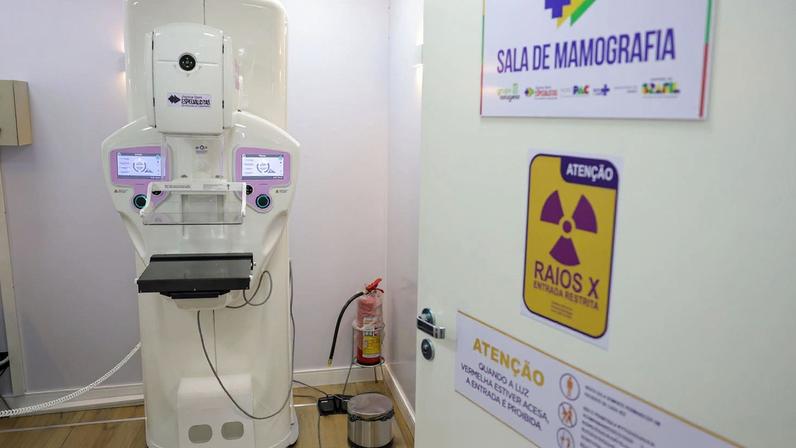 Brasília (DF) 23/10/2025 - Equipamento de mamografia da carreta de saúde da mulher do programa Agora Tem Especialistas no estacionamento do Hospital Regional de Ceilândia, cidade satélite de Brasília Foto: Fabio Rodrigues-Pozzebom/ Agência Brasil
