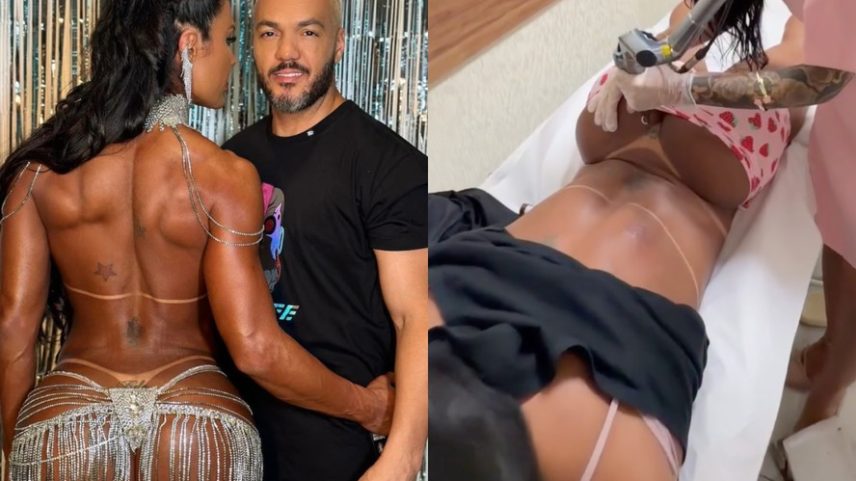 Ao som de Belo, Gracyanne Barbosa inicia retirada de tatuagem íntima dedicada ao ex e web reage: 'Fim de uma era' — Foto: Reprodução/Instagram