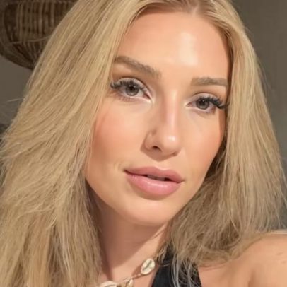 Amanda Meirelles detalha tratamento de lipedema e lipo na perna, diz ter mudado