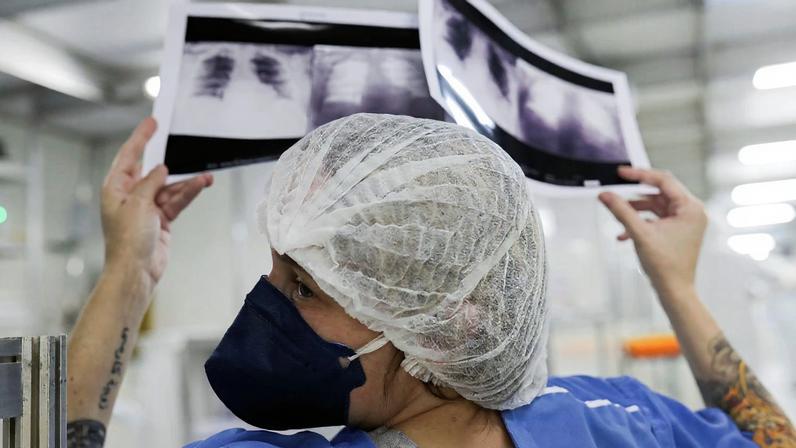 A doutora Luciana Souza compara duas radiografias de tórax diferentes de um paciente enquanto conversa com um colega de um hospital de campanha criado para tratar pacientes que sofrem da doença de coronavírus (COVID-19) em Guarulhos, São Paulo
