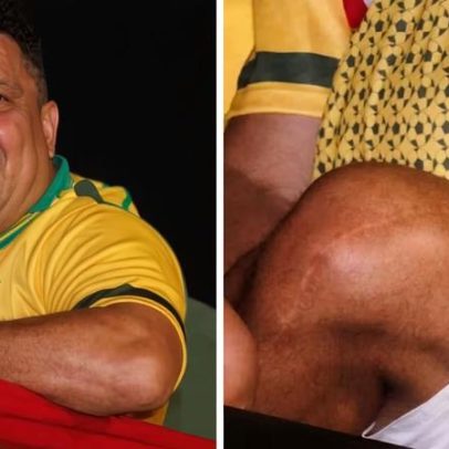 Ronaldo exibe cicatriz no joelho durante folia na Sapucaí