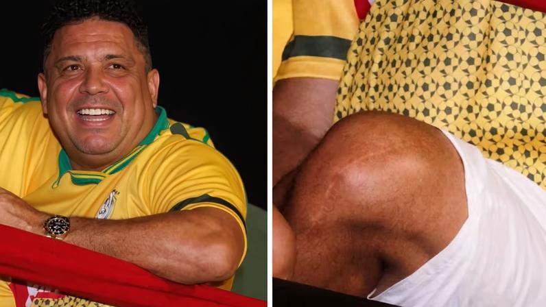Ronaldo exibe cicatriz no joelho durante folia na Sapucaí