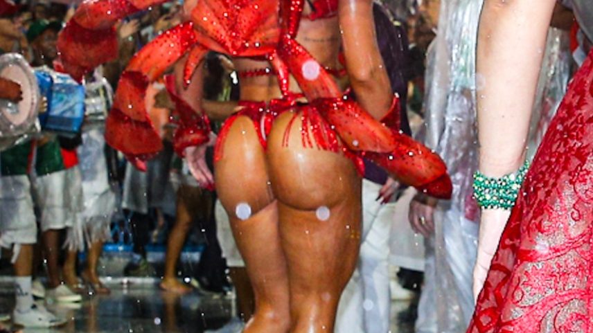 Musas e rainhas de bateria apostam em bioestimulador de colágeno para o bumbum