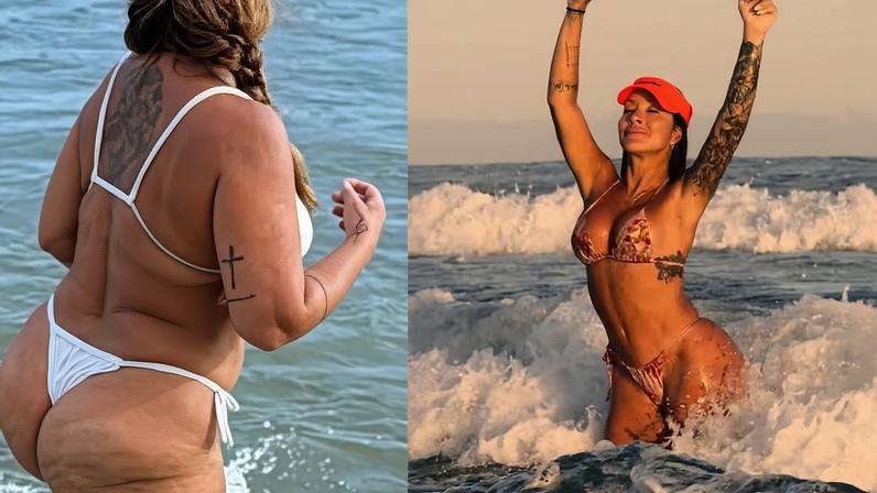 Vivi Fernandez revela antes e depois de procedimentos estéticos