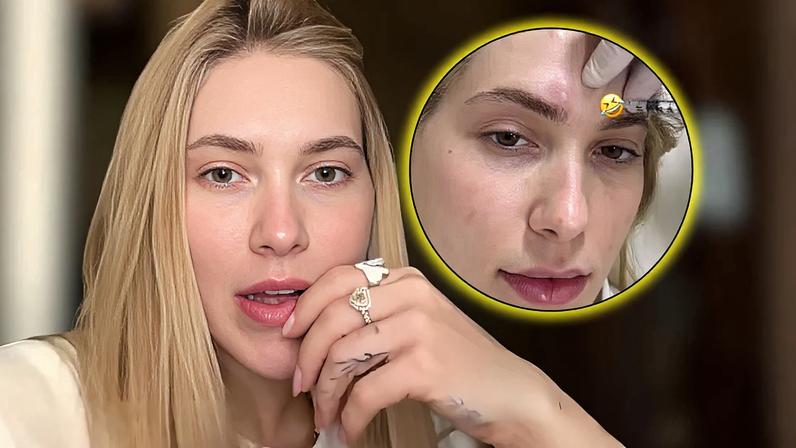 Aposente as dores intensas: o erro de Virgínia após 'espaçar' o tratamento de enxaqueca; entenda por que especialistas recomendam disciplina rigorosa para evitar o efeito rebote