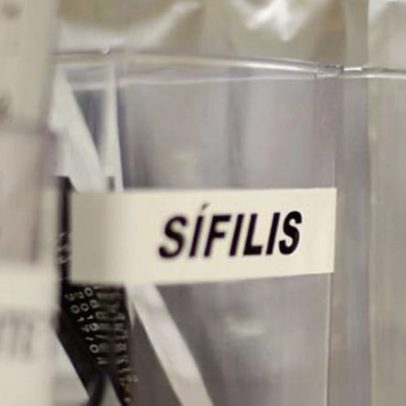 SUS adota antibiótico para prevenir sífilis e clamídia