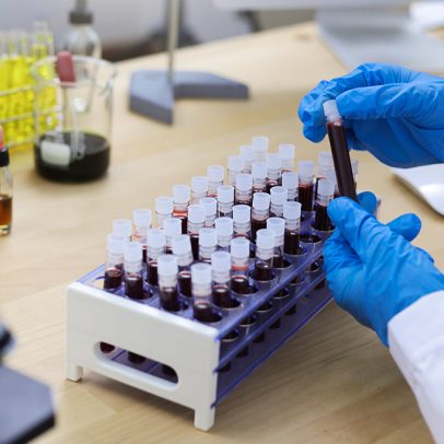 Pesquisa revela ISTs em 20% das gestantes avaliadas em Salvador