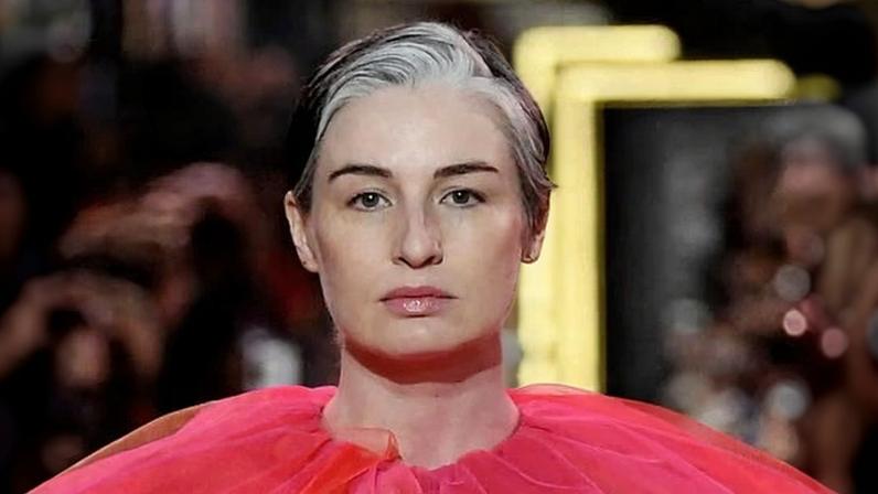 Instagram remove foto de gravidez de Erin O’Connor por nudez, diz ela