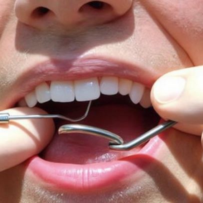 Regulador britânico de concorrência revisa odontologia privada após alta de 23%