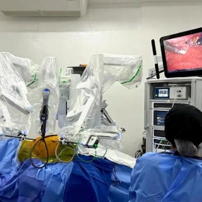 Paciente com coração do lado direito faz cirurgia cardíaca robótica