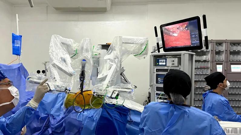 Fotografia de Médicos realizando uma revascularização do miocárdio (ponte de safena), utilizando tecnologia robótica