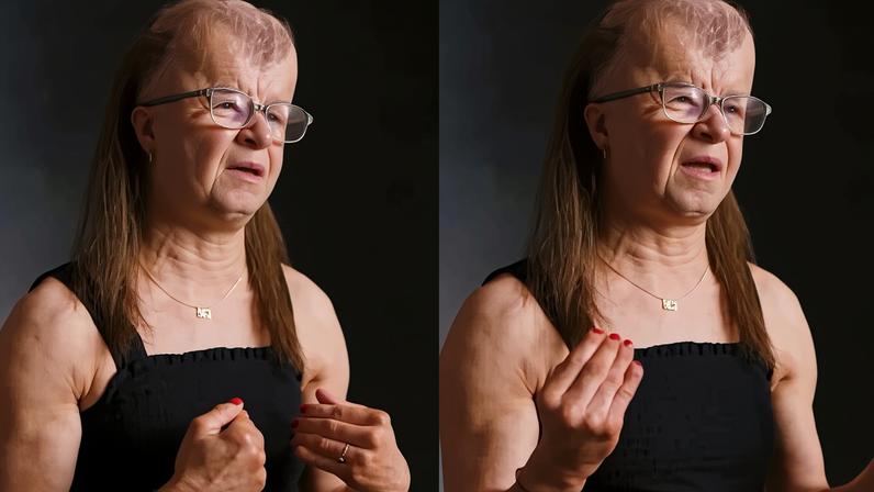 Mulher com síndrome de morte precoce diz viver cada dia como bênção