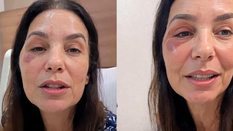 Nervo vago e síndrome vasovagal: explicação sobre diagnóstico de Ivete Sangalo