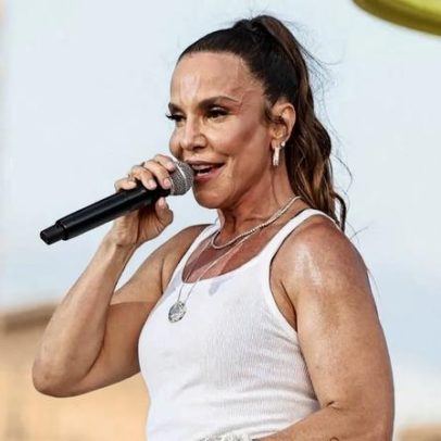 Ivete Sangalo corta glúten e lactose para inflamação intestinal, diz USP