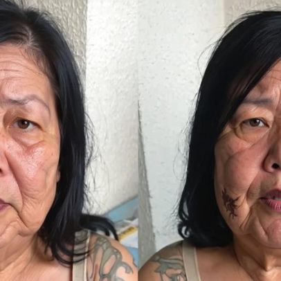 Juju do Pix faz nova cirurgia para remover óleo mineral do rosto; opiniões divididas