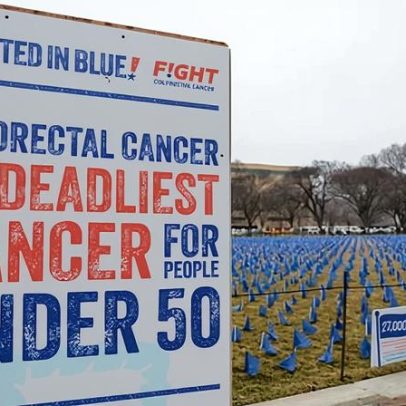 EUA: jovens abaixo de 45 enfrentam barreiras de seguro com câncer colorretal