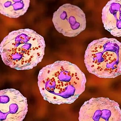 Especialistas estudam ampliar elegibilidade da vacina contra meningite após surto em Kent