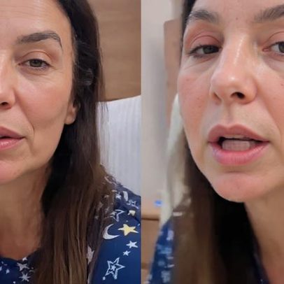 Ivete Sangalo sofre duas fraturas no rosto após desmaio, passa por cirurgia