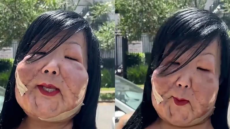 Juju do Pix exibe novo resultado de cirurgia plástica, mas é detalhe no rosto que rouba a cena: 'Olha que lindo, ficou babado'