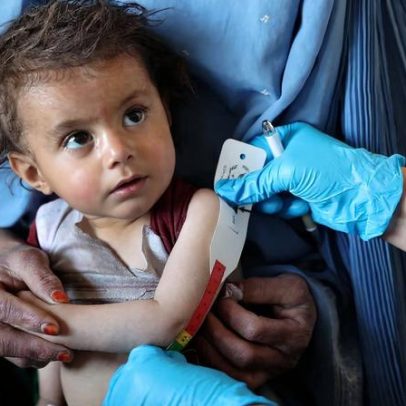 ONU alerta 200 mil crianças afegãs com desnutrição aguda em 2026