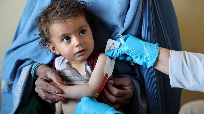 ONU alerta 200 mil crianças afegãs com desnutrição aguda em 2026