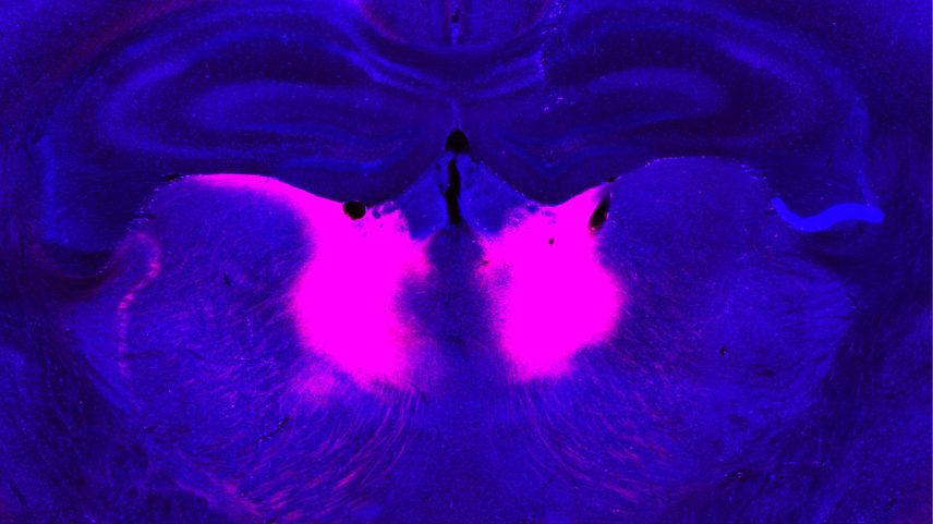 MIT researchers have identified neurons in the mediodorsal thalamus (labeled pink) whose dysfunction can lead to impairments in the ability to update beliefs based on new information.