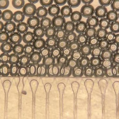 Fígado satélite injetável pode oferecer opção ao transplante de fígado