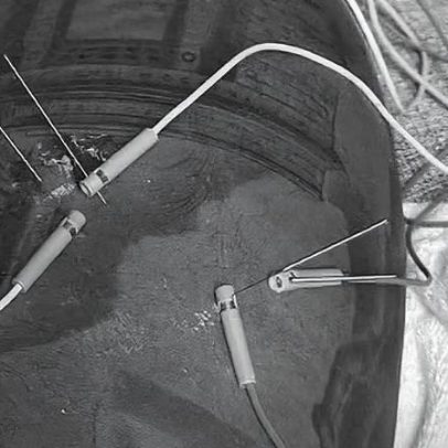 Memphis inicia tratamento após lesão na coxa e mira retorno em breve