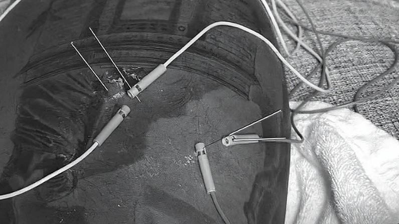 Memphis trata lesão na coxa direita