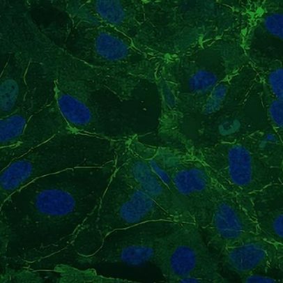 Genética por trás de vasos cerebrais permeáveis na síndrome de Rett