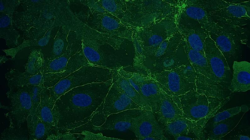 MIT scientists investigated how genetic mutations that cause the disorder Rett syndrome affect the brain’s blood vessels. The Rett syndrome endothelial cells seen here showed less expression of ZO-1 (green), a key protein for forming a tight seal in blood vessels, than control cells (not pictured).