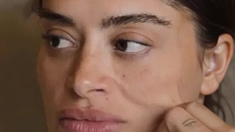 Lifting facial de Aline Campos aos 38 reacende debate sobre idade para cirurgia