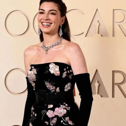 Anne Hathaway revela truque de lifting instantâneo usado no Oscar 2026