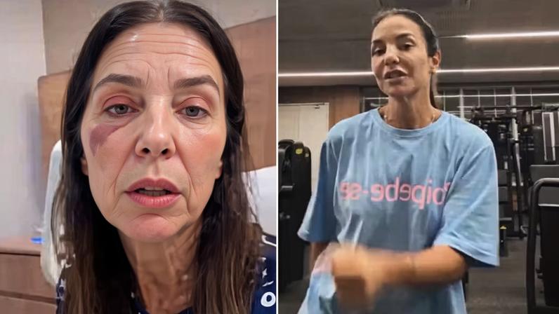 Ivete Sangalo retoma treinos após cirurgia no rosto e celebra retorno