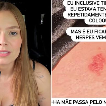 Viih Tube afirma ter removido DIU após herpes repetidas vezes