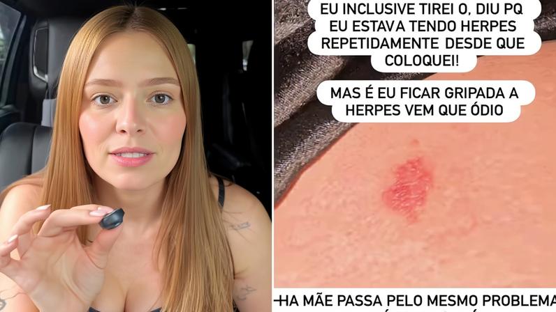 Viih Tube afirma ter removido DIU após herpes repetidas vezes