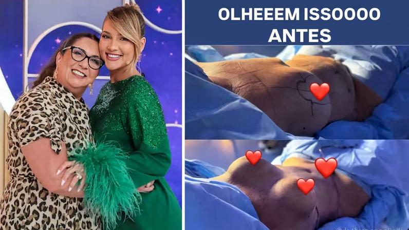 Virginia Fonseca mostra resultado da cirurgia plástica da mãe