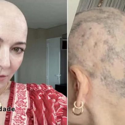 Mãe de Lucas Lucco mostra foto de perto e desabafa sobre falhas visíveis